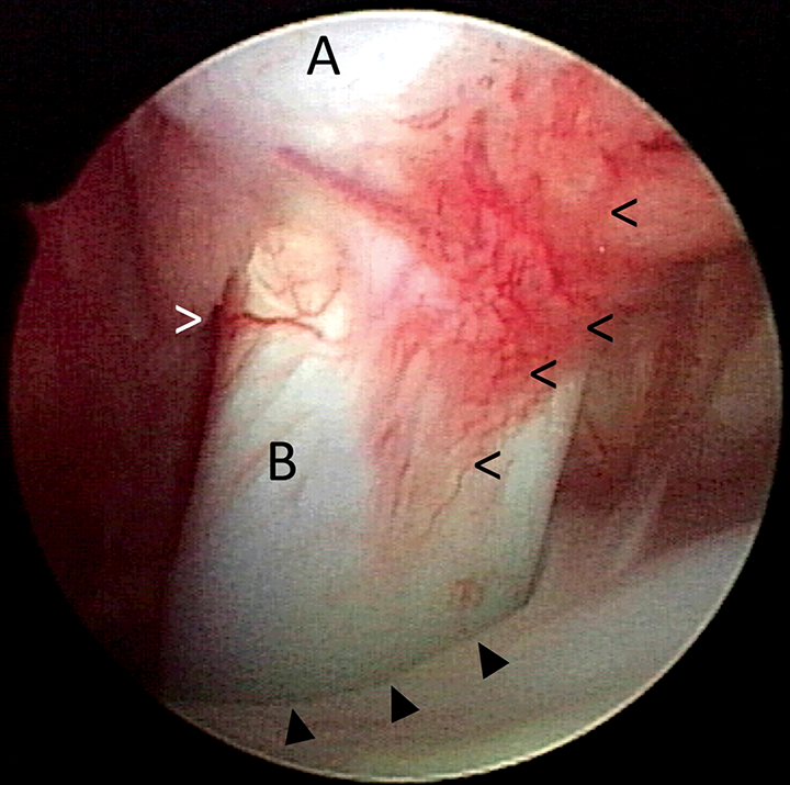 top 5 muscle tendon injuries in lame patients clinician s brief