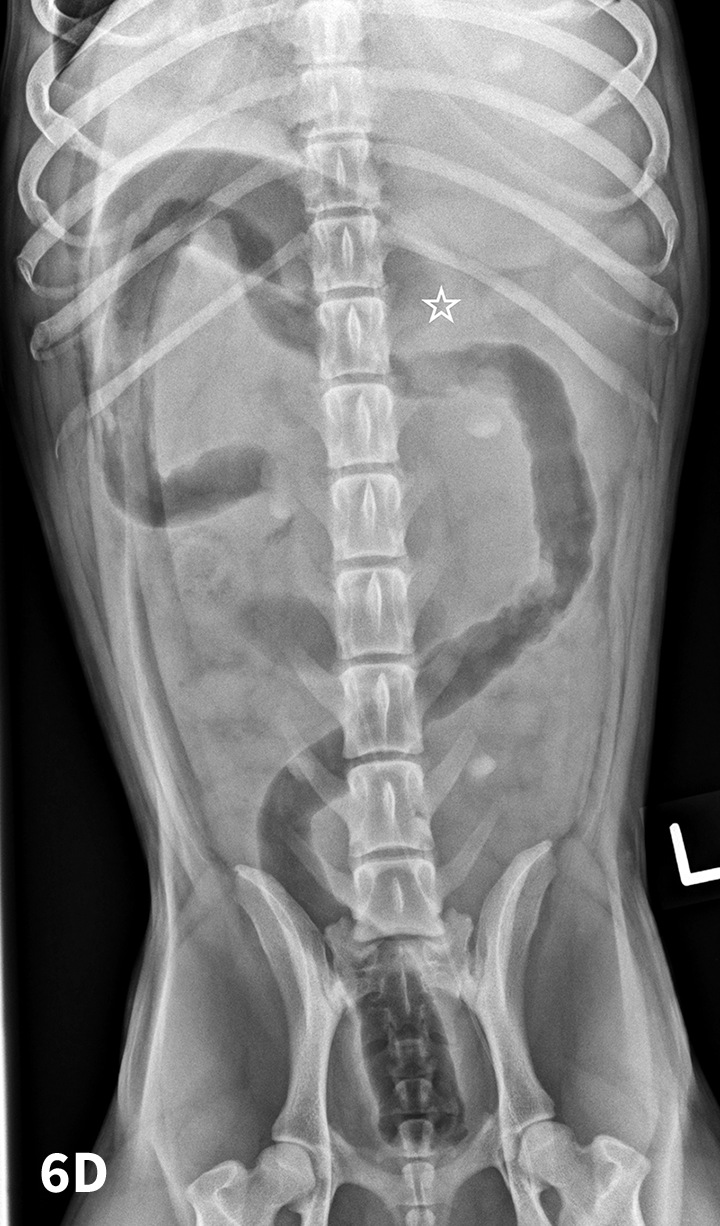 Top 5 Tips on Radiographic Diagnosis of Obstructive Foreign Bodies