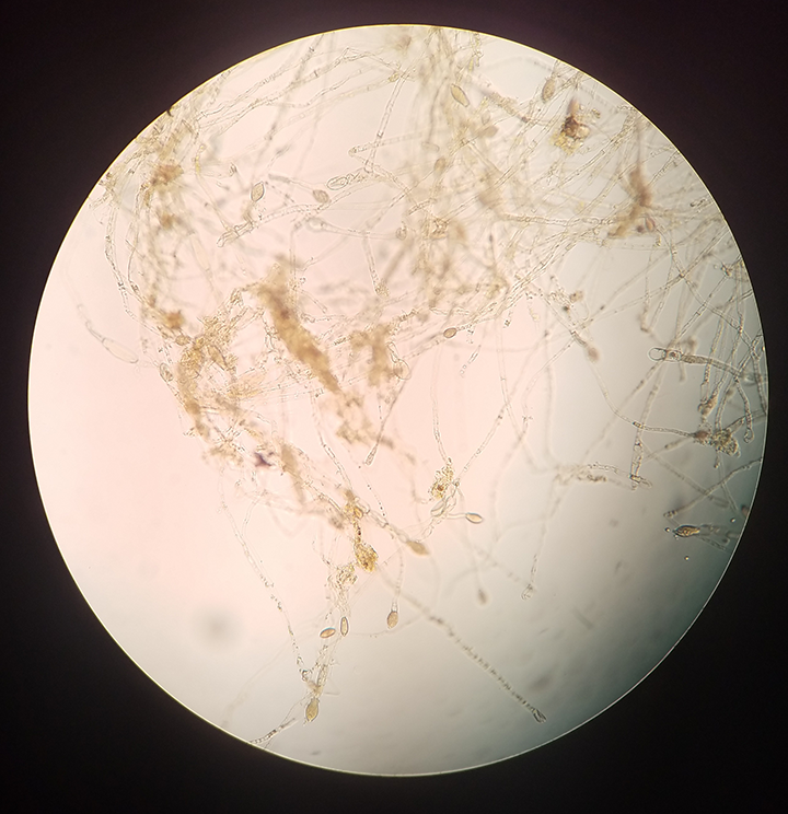 Image Gallery Fish Diseases Clinician's Brief