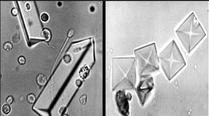 feline struvite crystals