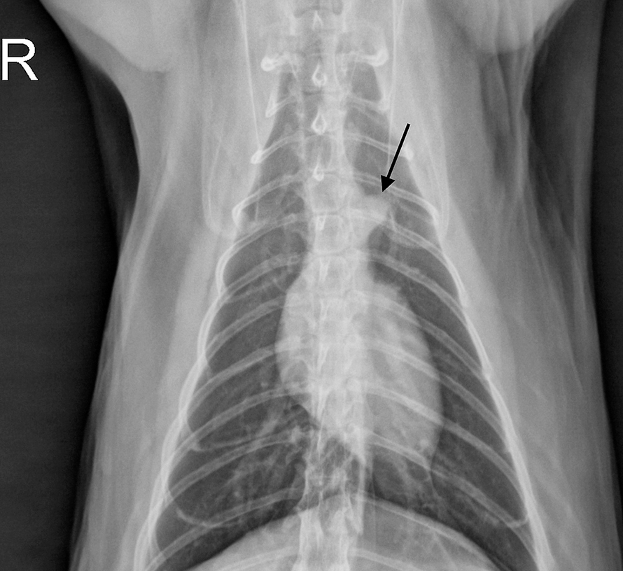 Top 5 Radiographic Variants Clinician's Brief