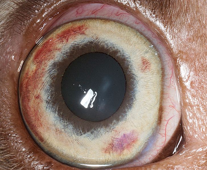 Diseases of the Iris & Anterior Chamber Clinician's Brief