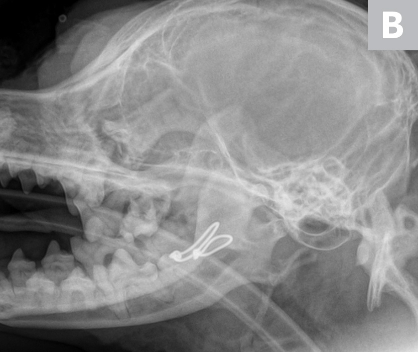 Jaw Fractures Clinician's Brief