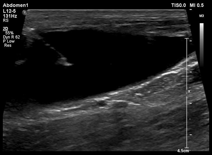 Guide to Performing Cystocentesis in Dogs & Cats Clinician's Brief