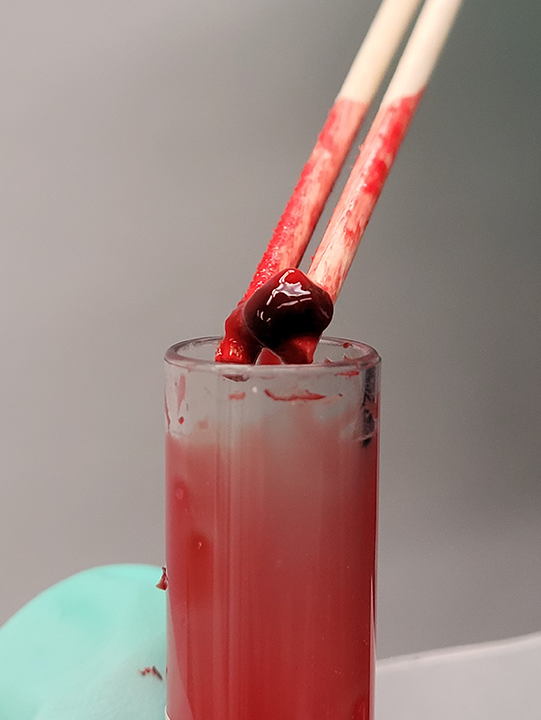 Top 5 Blood Collection & Sampling Errors Clinician's Brief