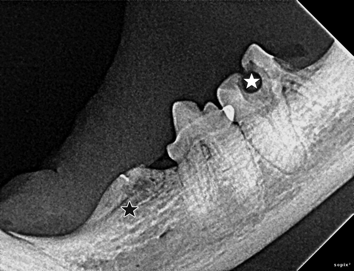Interpreting Dental Radiographs Clinician's Brief