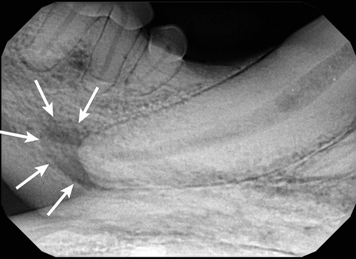 Interpreting Dental Radiographs Clinician's Brief