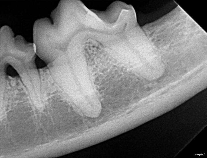Interpreting Dental Radiographs Clinician's Brief