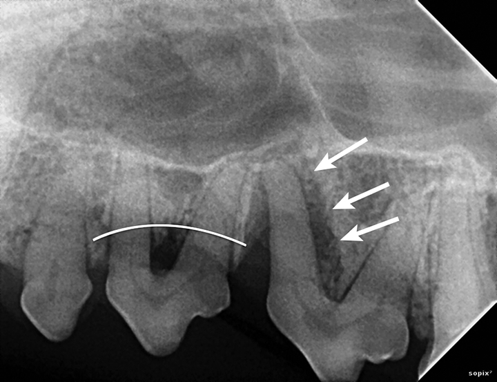 Anterior Radiographs Dental