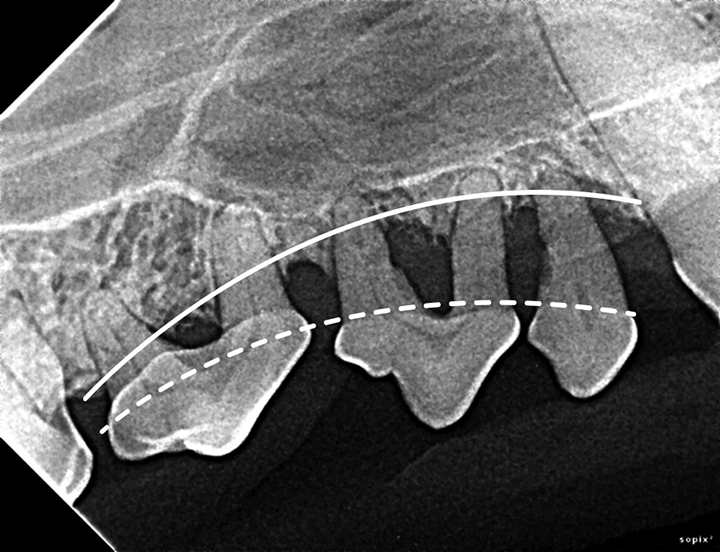 Interpreting Dental Radiographs Clinician's Brief