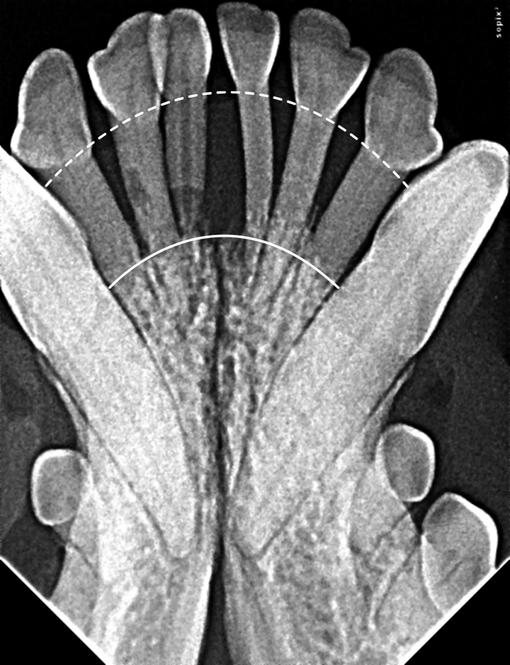 Interpreting Dental Radiographs Clinician's Brief