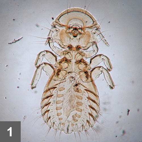 Parasites of Backyard Chickens Clinician's Brief