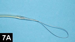 Percutaneous Endoscopic Gastrostomy Tube Placement | Clinician's Brief