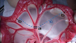 Small Intestinal Resection & Anastomosis | Clinician's Brief