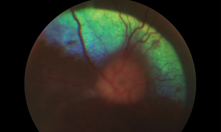 Thomas Chen Clinician S Brief