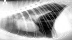 Detection Treatment Of Pneumothorax Clinician s Brief