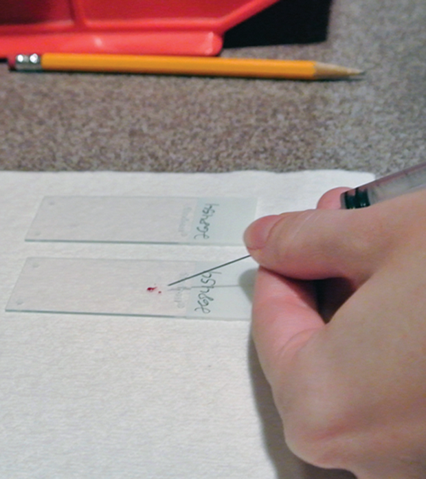 FineNeedle Aspiration of the Liver Clinician's Brief