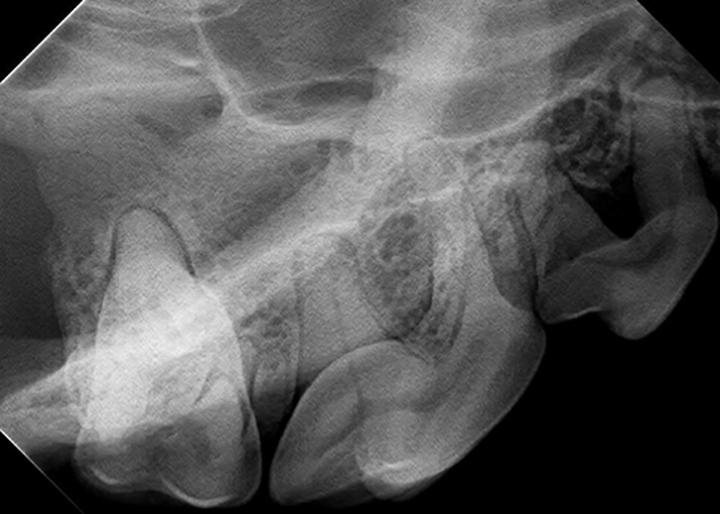 Dental Radiographs Positioning is Everything Clinician's Brief