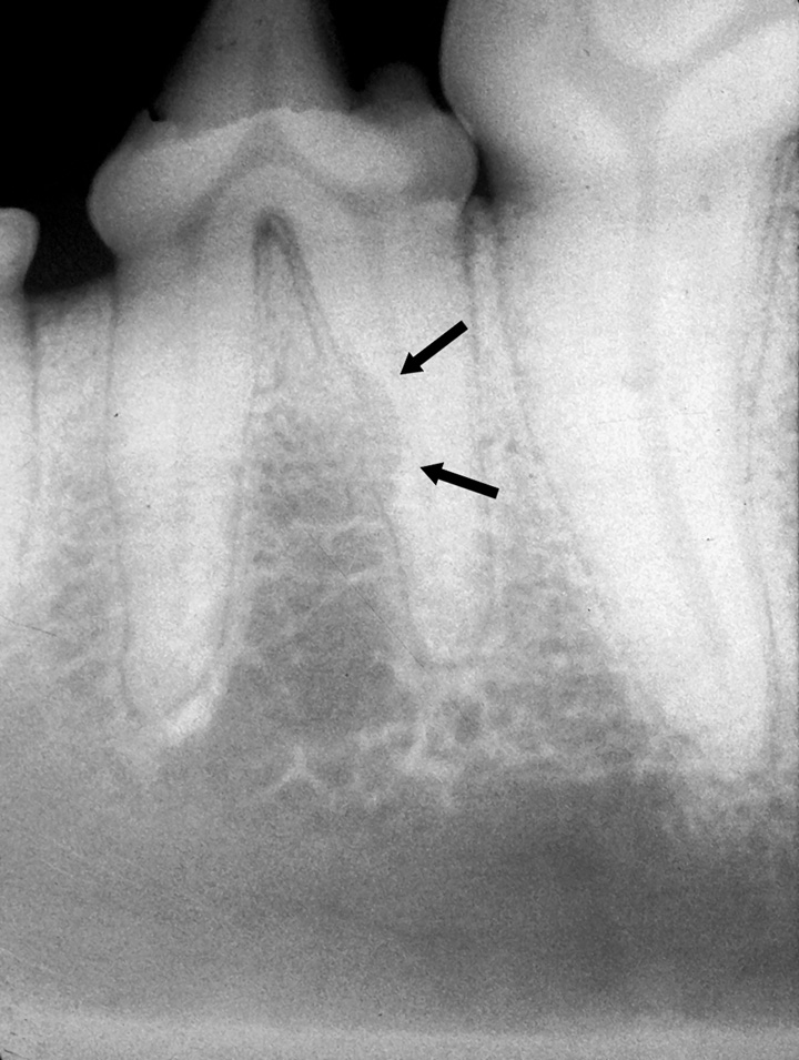 Treating Tooth Resorption in Dogs Clinician's Brief