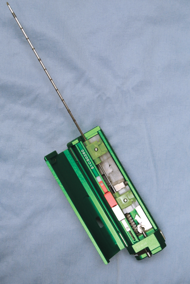 UltrasoundGuided Biopsy of the Liver Clinician's Brief