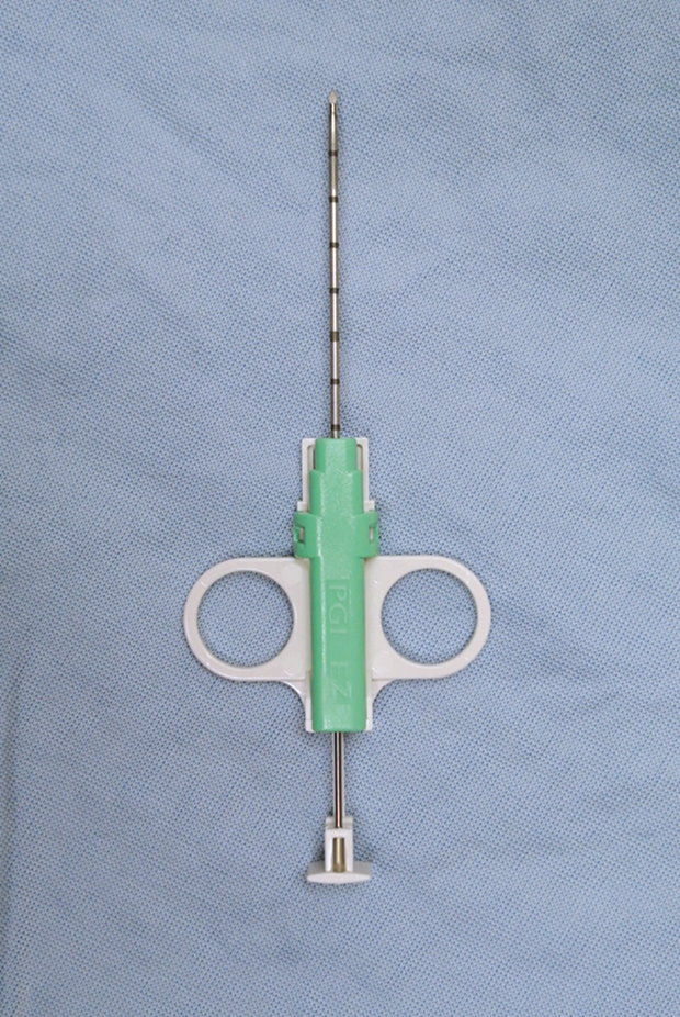 UltrasoundGuided Biopsy of the Liver Clinician's Brief