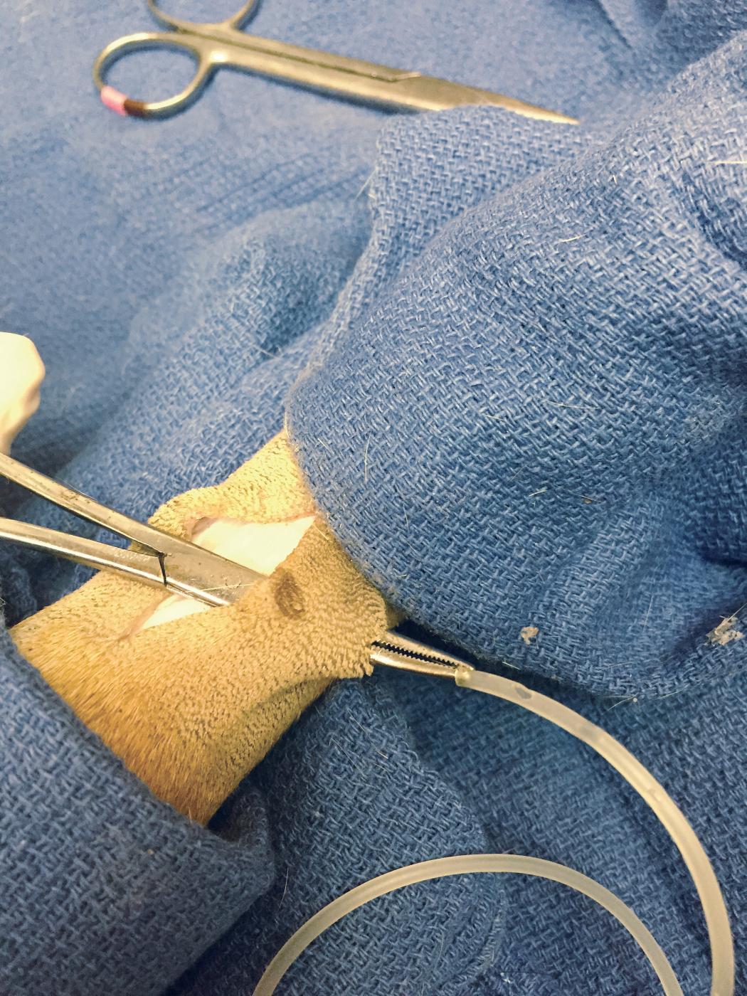 Surgical Drains for Wound Management Clinician's Brief