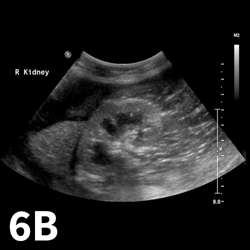 Abdominal Focused Assessment with Sonography for Trauma | Clinician's Brief