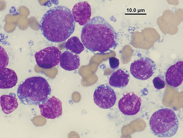 Cat with a Cloudy Eye Clinician's Brief