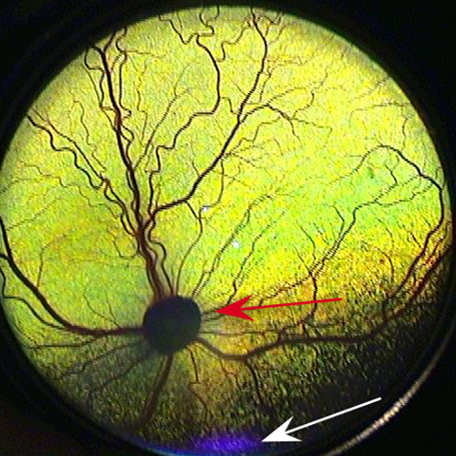 Image Gallery: Canine Fundus Diseases | Clinician's Brief