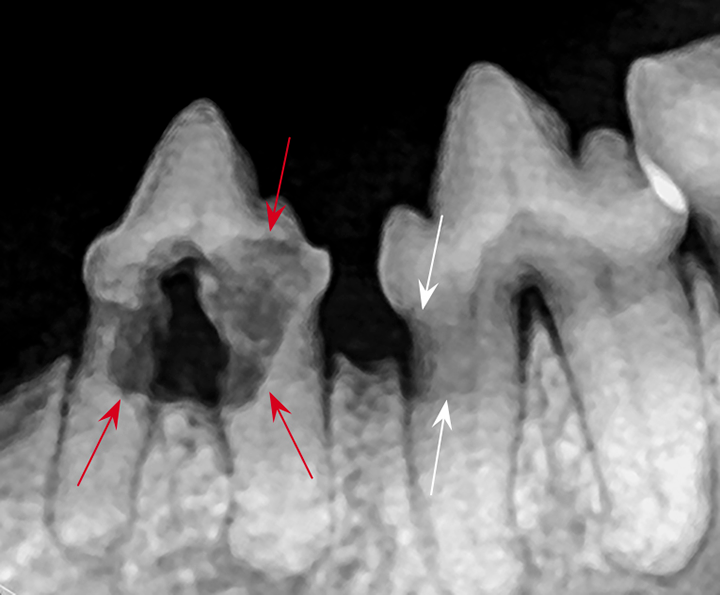 Image Gallery Dental Radiography Clinician's Brief