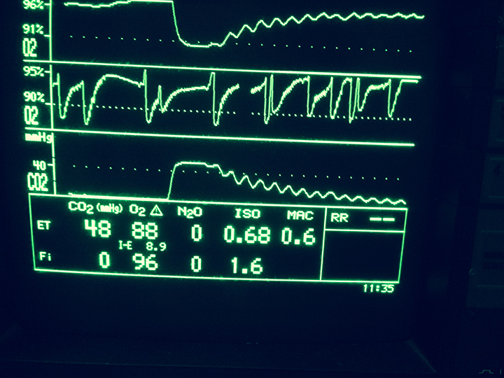 Image Gallery Capnography Clinician's Brief