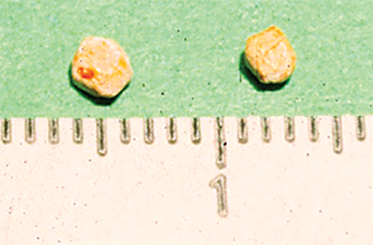 feline struvite crystals