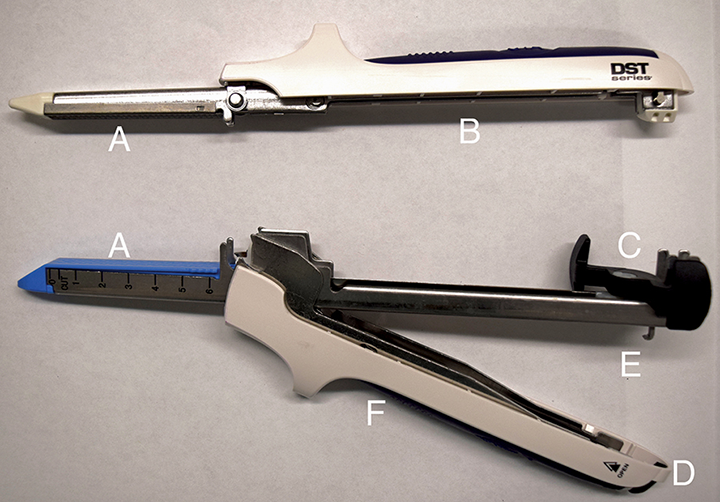 LinearStapled Gastrointestinal Anastomosis Clinician's Brief