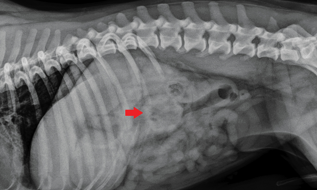 Image Quiz Foreign Body Ingestion Clinician s Brief