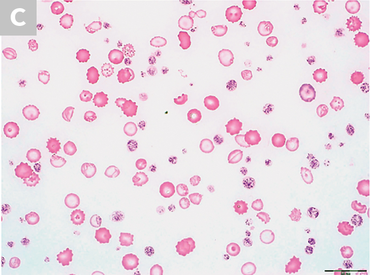 Blood Smear Png / 5,000+ vectors, stock photos & psd files. - Iwant-You4