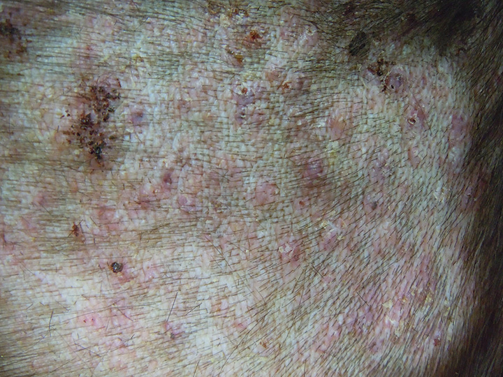 Clinical Suite MRSP Infections in Dogs & Cats Clinician's Brief